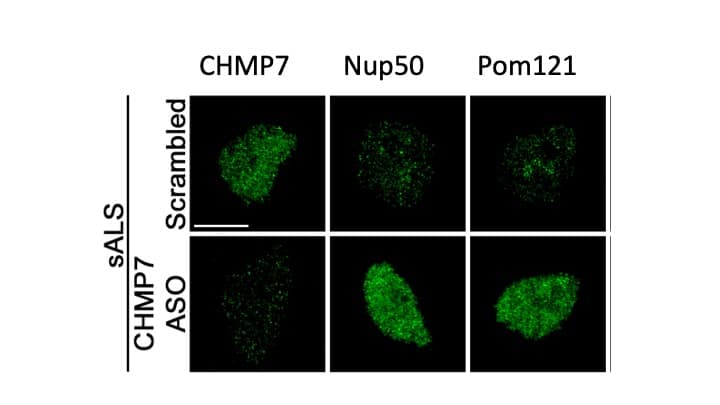 A slide detailing the protein CHMP7.